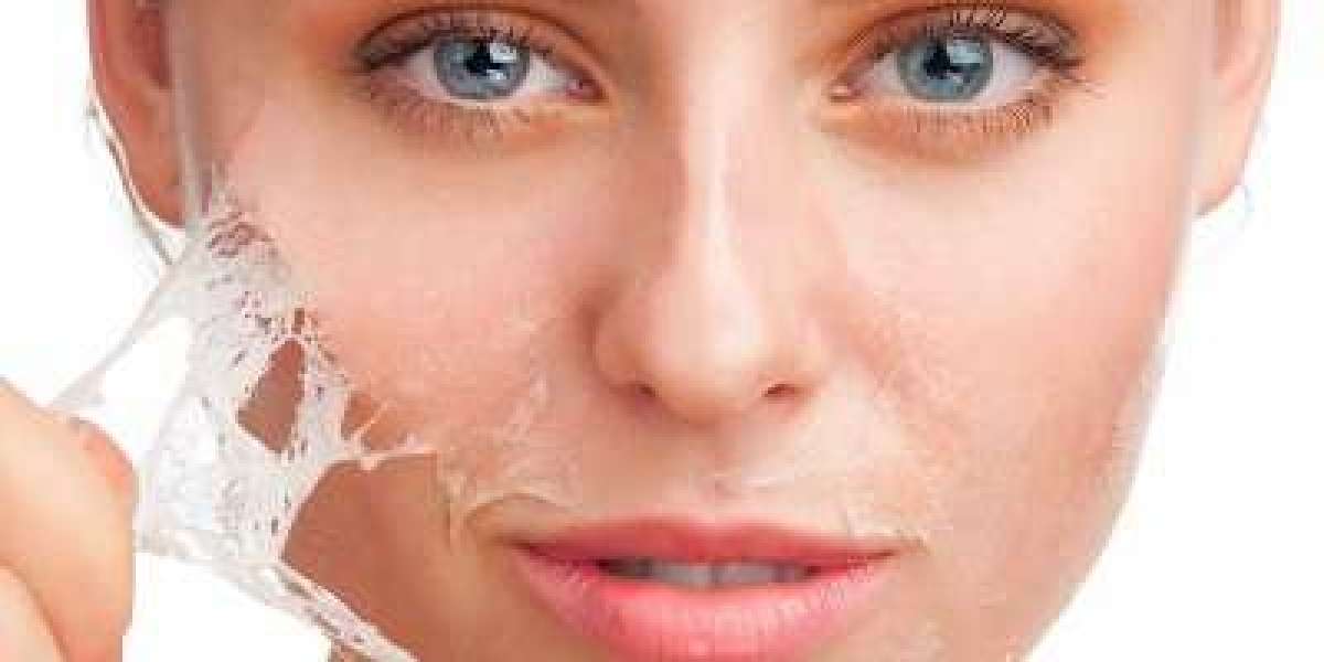 Chemical Peeling in Riyadh Non-Surgical Glow