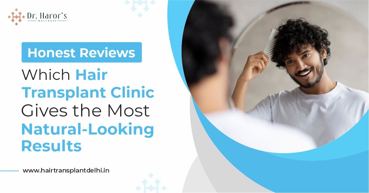 Honest Reviews: Which Hair Transplant Clinic Gives the Most Natural-Looking Results
