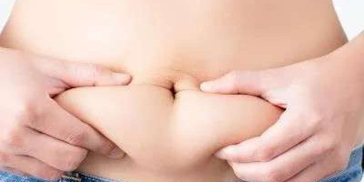 Recovery Timeline After Liposuction in Islamabad