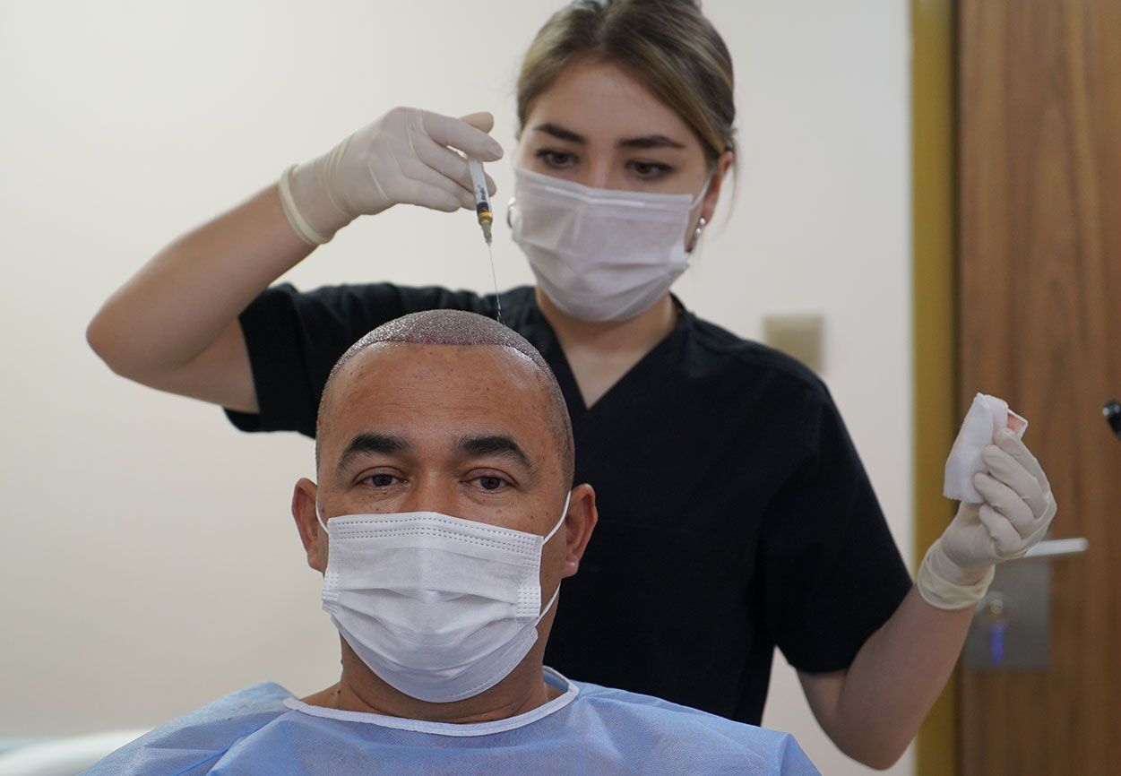 Step-by-Step Guide to Getting Hair Treatment in Turkey - Newsglo