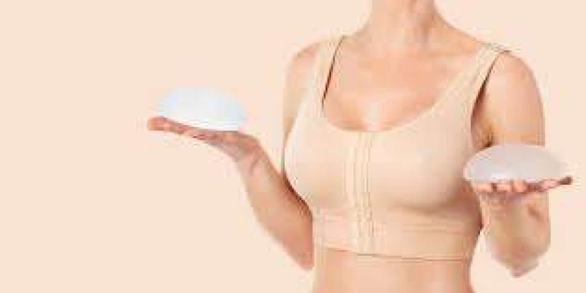 Combining Breast Lift with Implants for Stunning Results