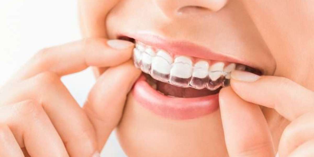 Invisalign Braces Dubai: Straighten Your Teeth Comfortably and Invisibly