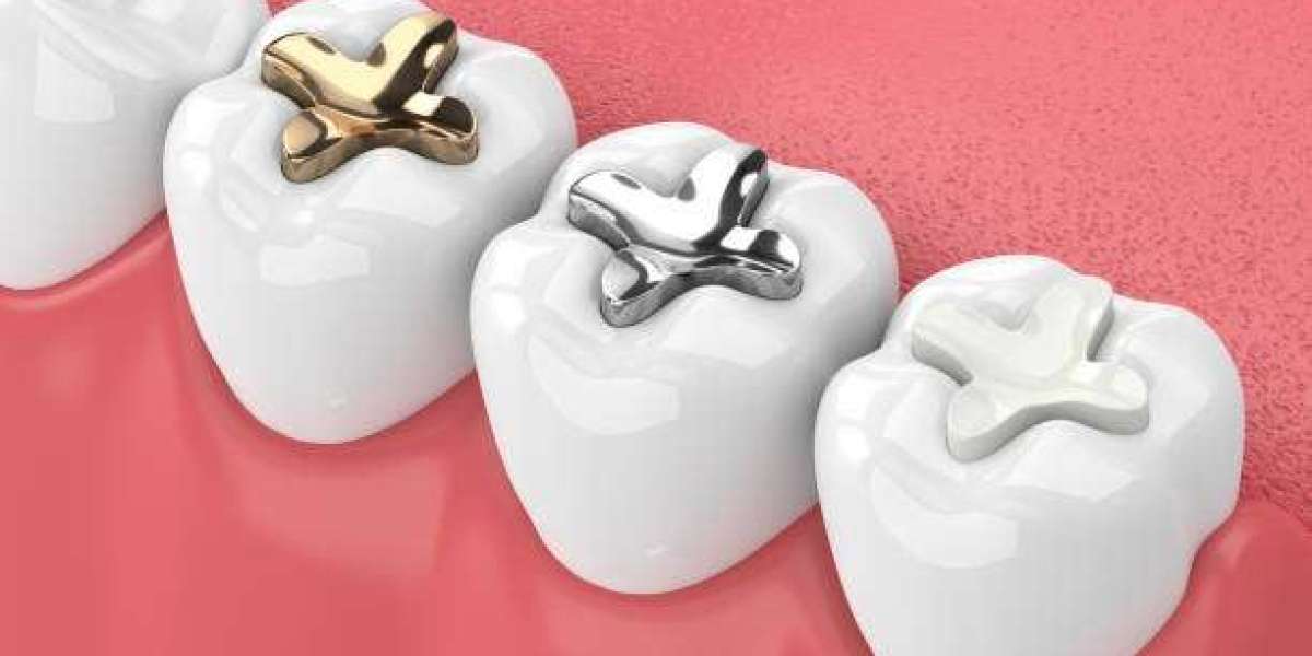 Protect Your Teeth with Reliable Dental Fillings