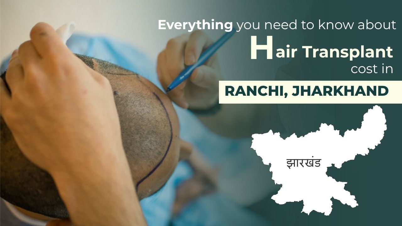 Hair Transplant in Ranchi, Jharkhand | Cost, Procedure & Best Doctor