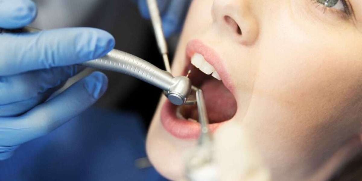 Dental Implants vs Dentures: Which Is Better?