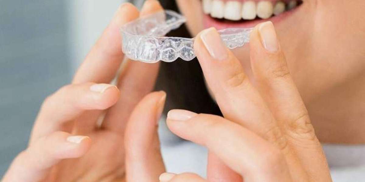 The Multifaceted World of Braces: Stability, Alignment, and Fashion Many Uses of Braces in Modern Life