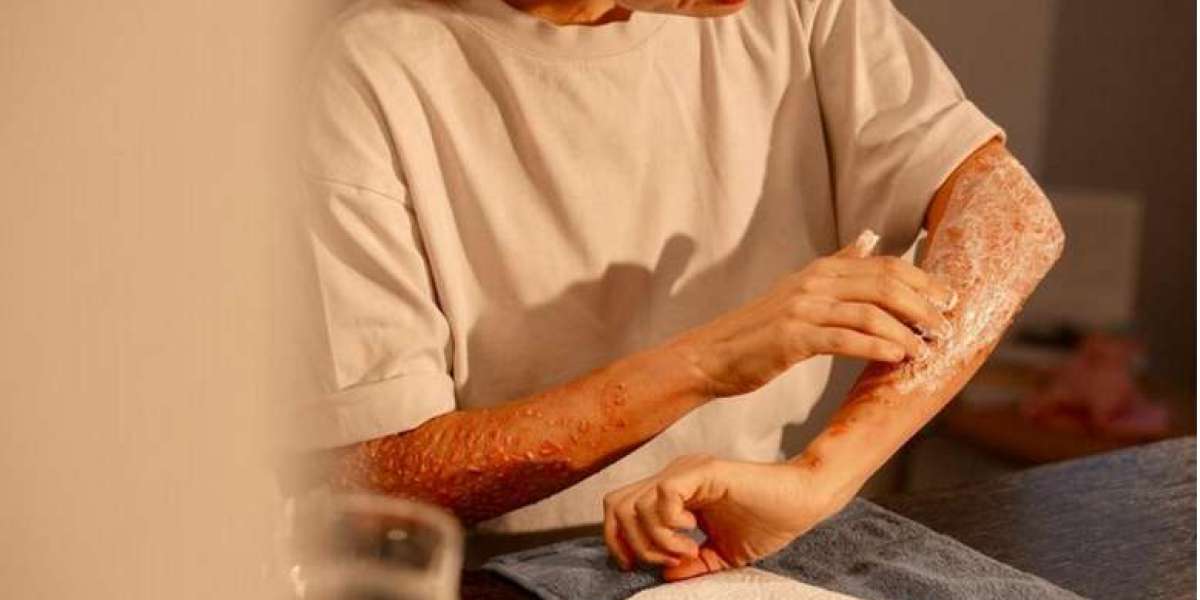 How Homeopathy Works at the Cellular Level in Vitiligo