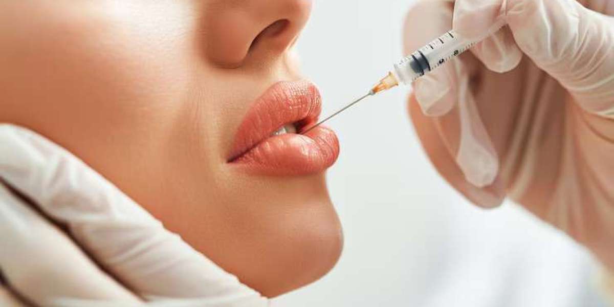 Lip Filler in Islamabad for Men: A Growing Trend