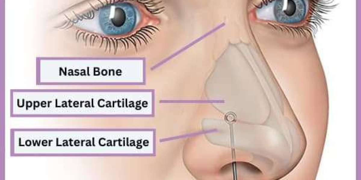 Nose Tip Plasty in Islamabad: Complete Guide for Patients