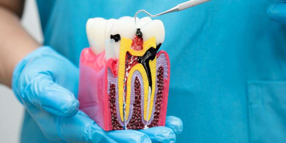 Root Canal Treatment: Early Warning Signs You Shouldn’t Ignore