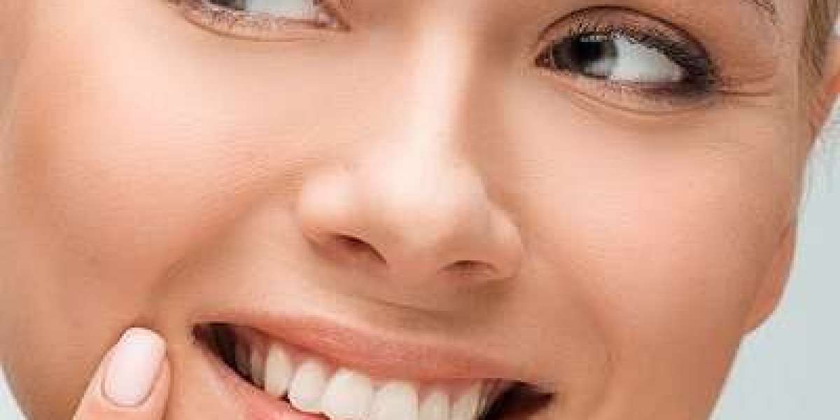 Teeth Whitening in Islamabad – Restore Your Smile at Enfield Royal Clinic