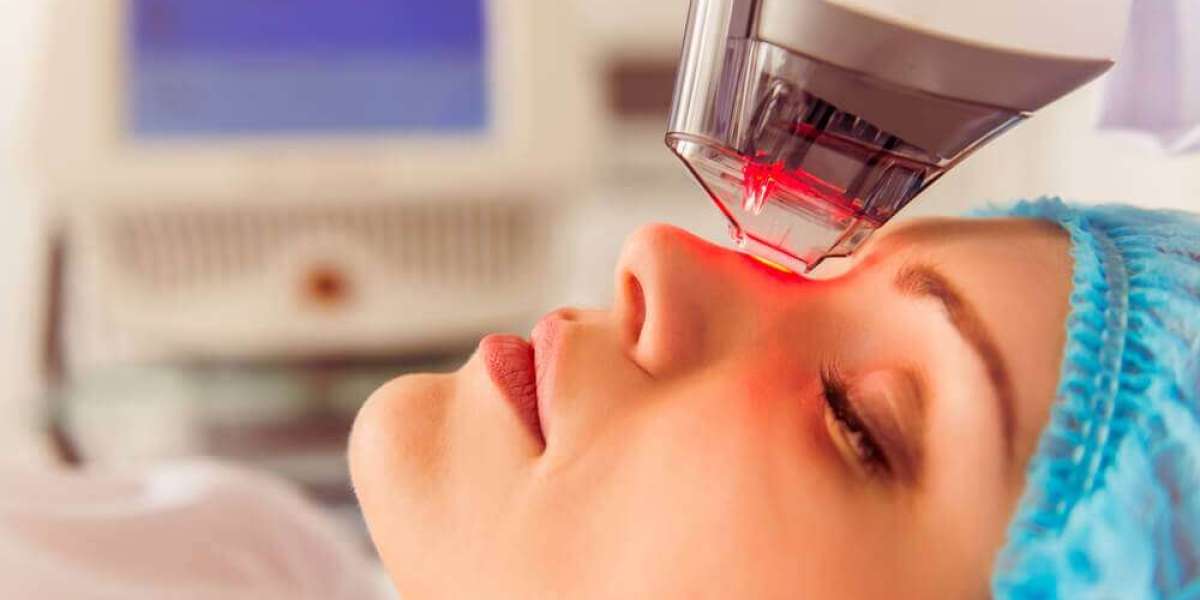 Laser Treatments: Advanced Technology for Skin