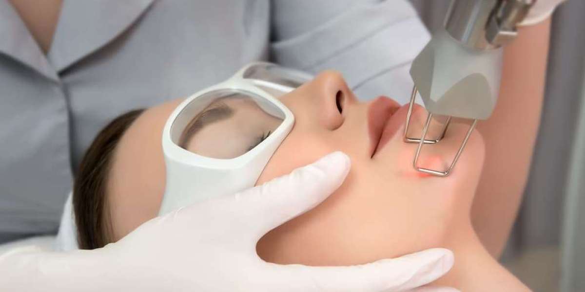 Can Fractional CO2 Laser Cost Reveal Smooth Skin and Shrink Pores Quickly