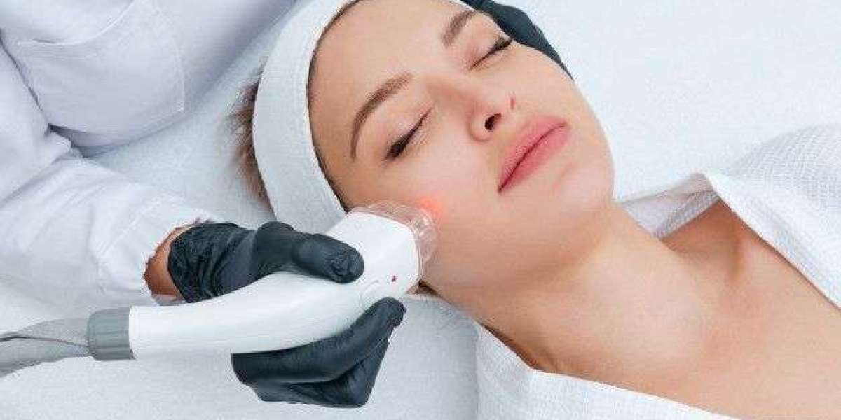 Introduction to Face Brightening with Laser