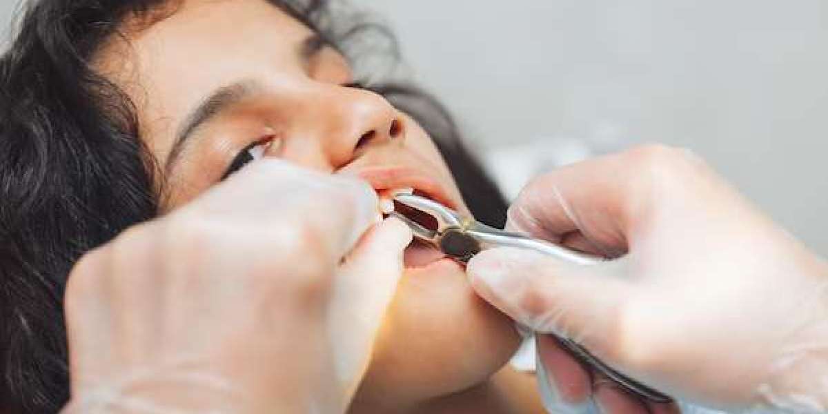 Tooth Extraction: Local Anesthetic and Surgical Removal Techniques