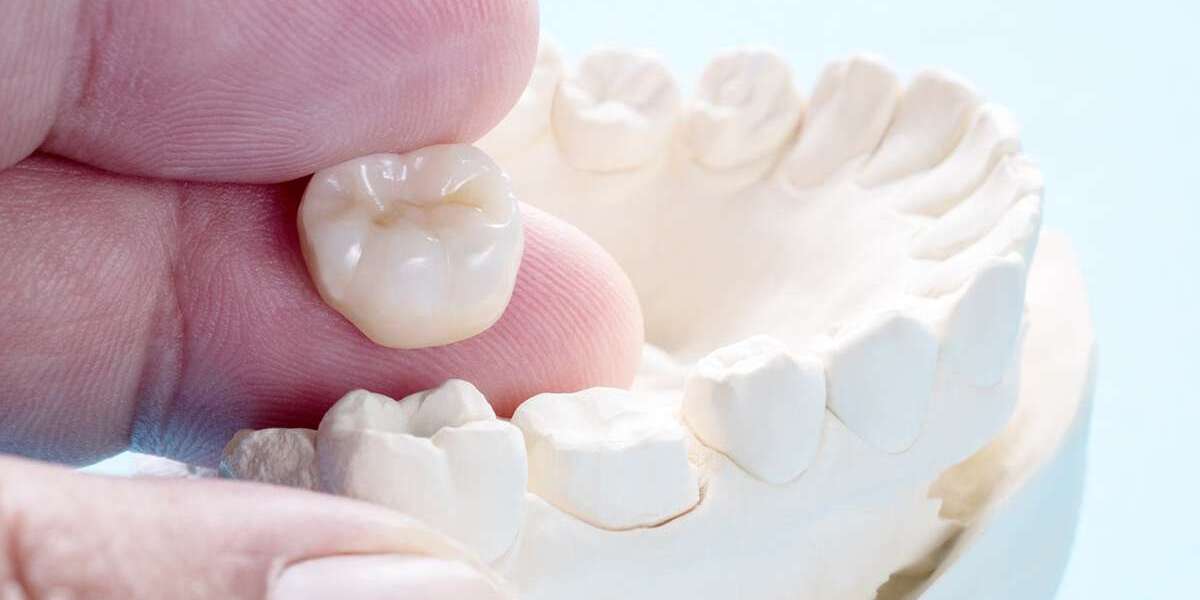 Benefits of Getting a Dental Crown Dubai for Damaged Teeth