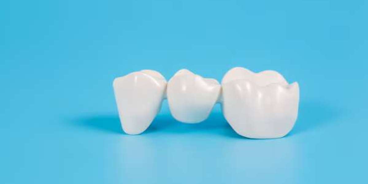 The Solution for Damaged Teeth and Reasons to Consider Dental Crowns