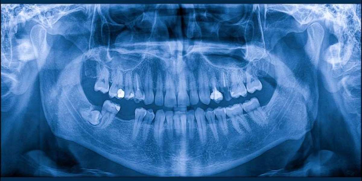 Premium Dental Care Dubai | Panoramic