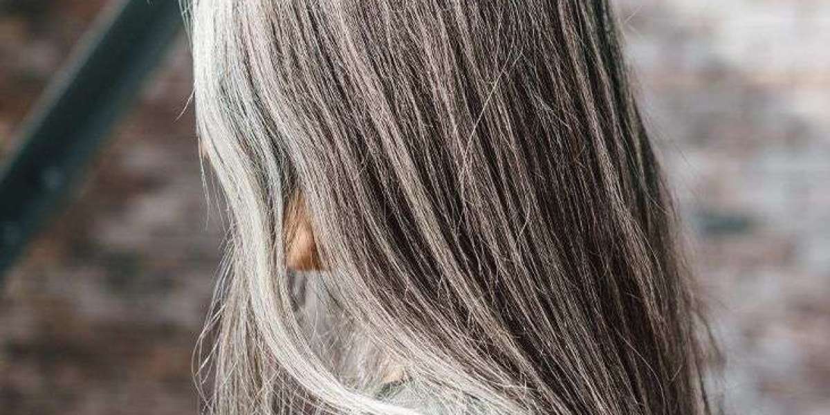 White Hair Removal Dubai: Everything You Need