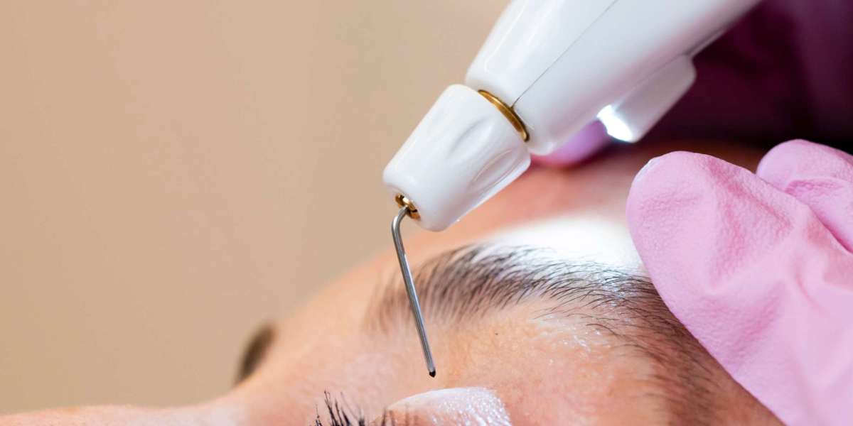 Is Plasma Pen Treatment Suitable for All Skin Types?