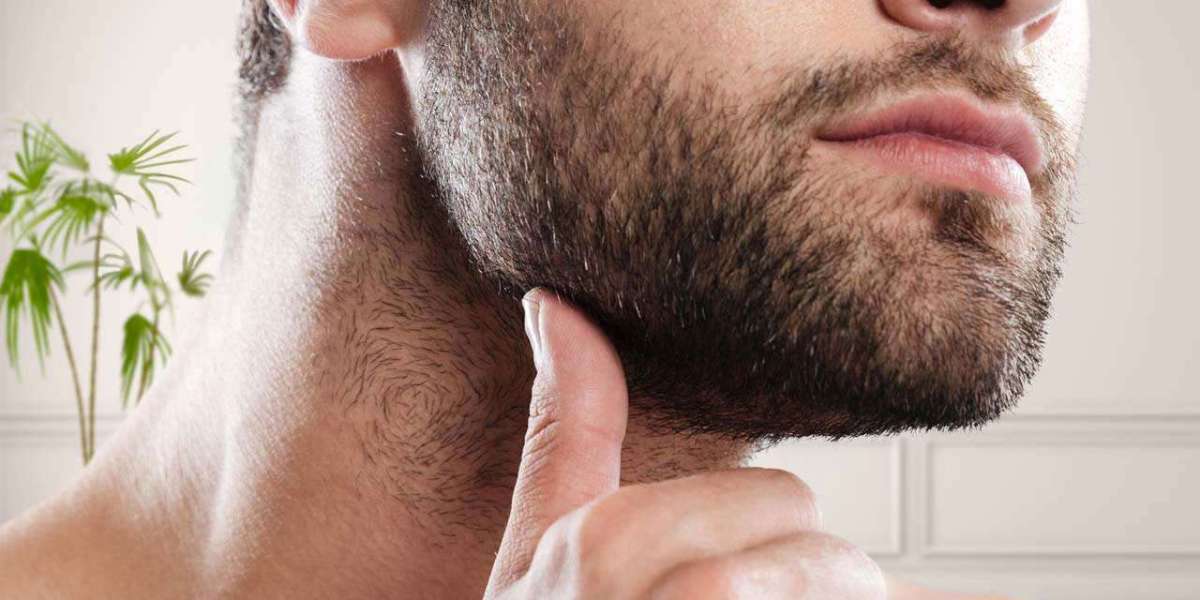 What is the Success Rate of Beard Hair Transplants?