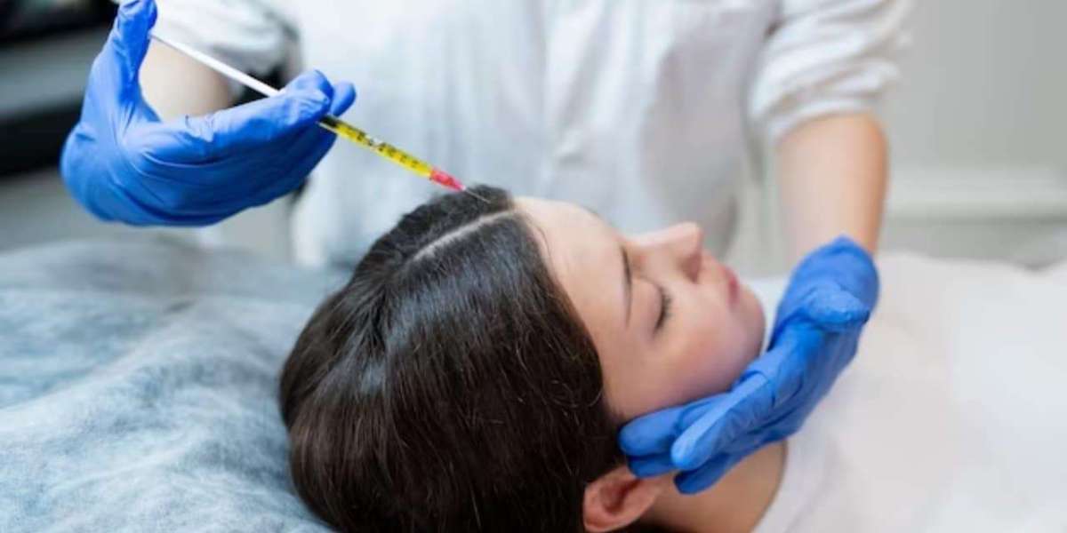 Who is a Good Candidate for Prp Hair Treatment?