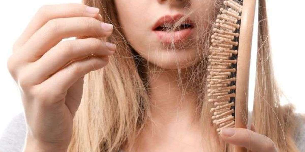 Hair Loss Treatment in Islamabad for Severe Hair Fall