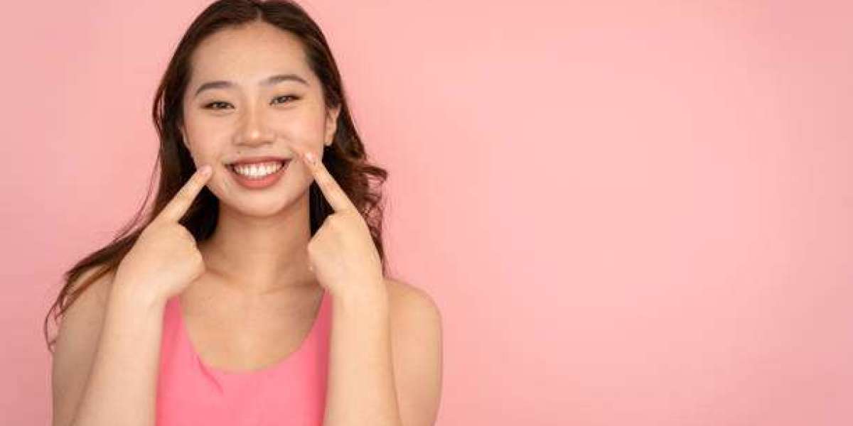 How does dimple creation work?