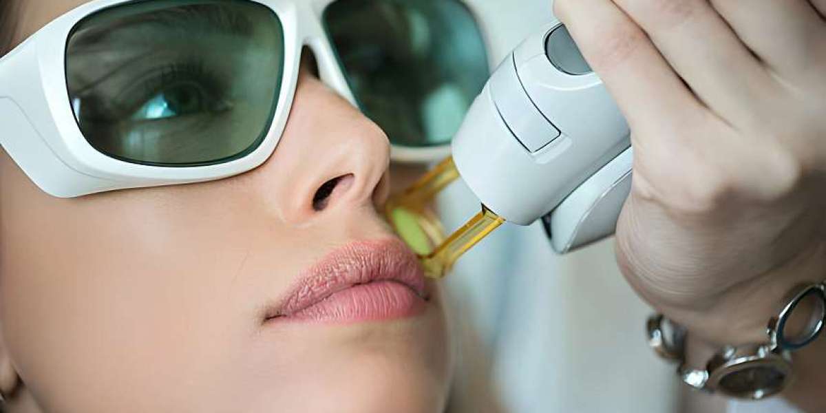 Is Laser Hair Removal the Future of Hair Removal?