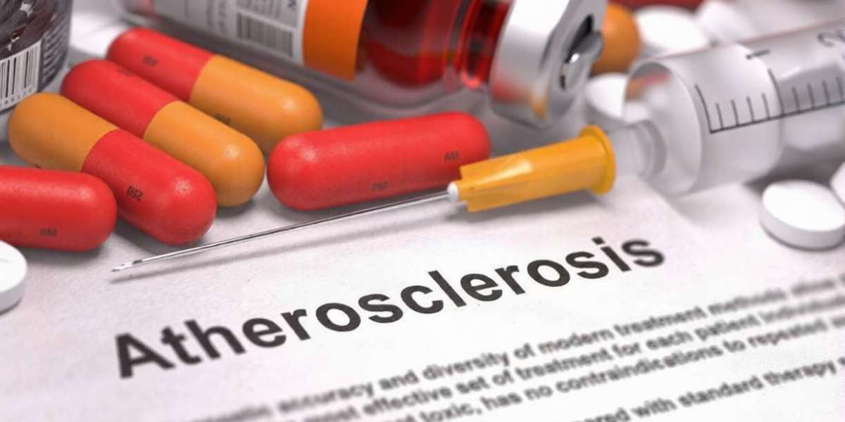 Atherosclerosis Drugs Market Opportunities Driving Smarter Cardiovascular Treatment Investment Decisions Worldwide