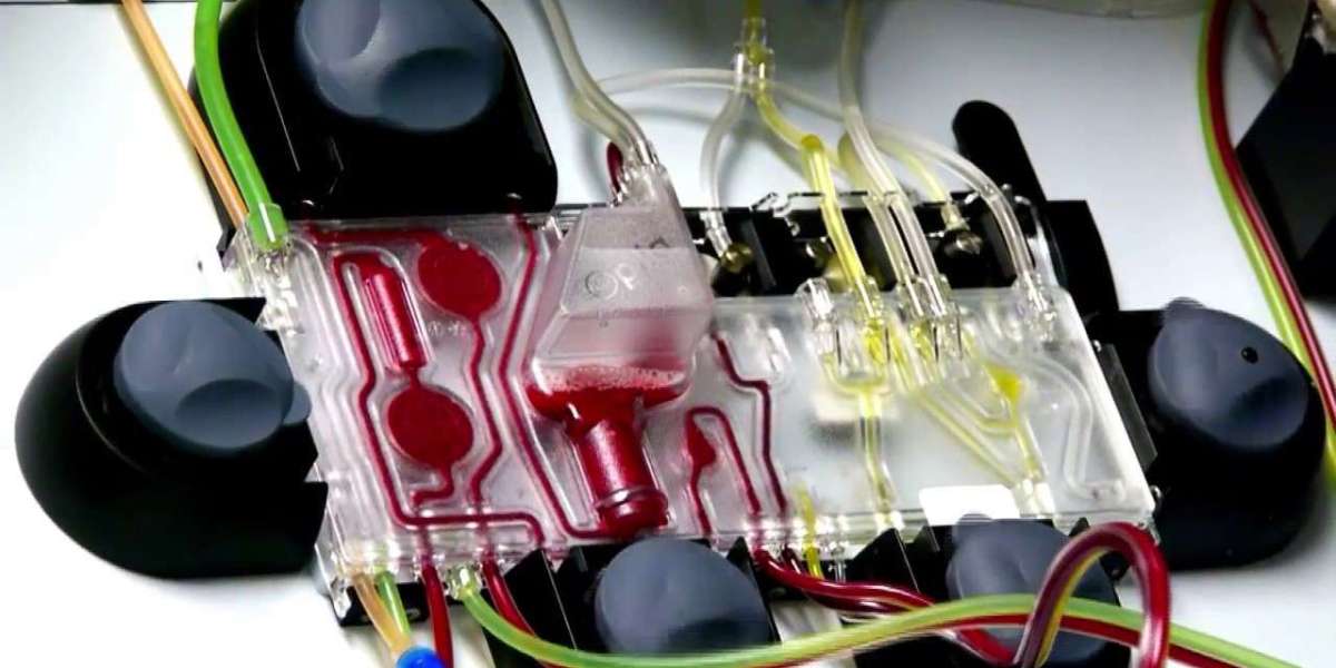 Apheresis Market Dynamics Highlights Apheresis Types Clinical Applications Shaping Global Healthcare Treatment Trends