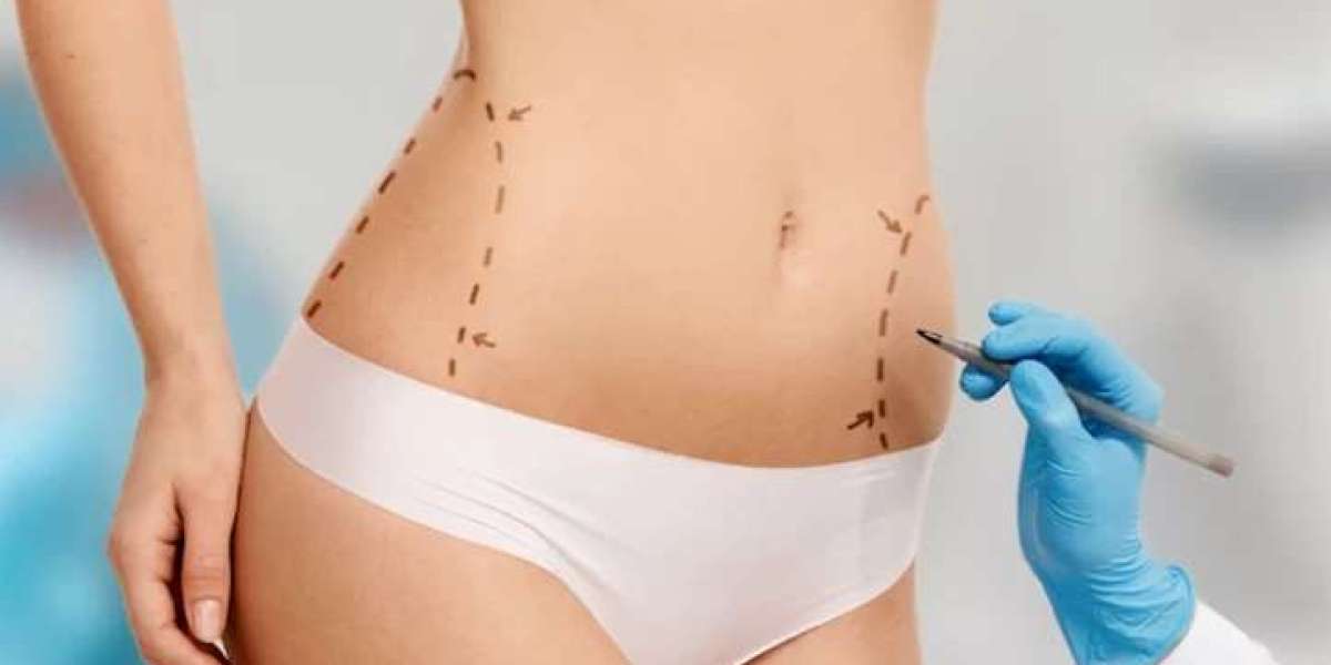 What Are the Signs of Liposuction Complications?