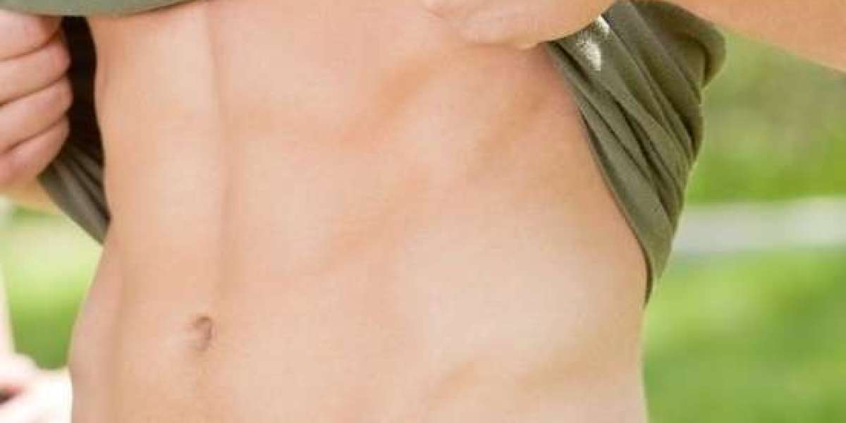How Do You Prepare for Liposuction Surgery?