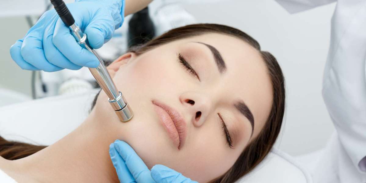 What is Microdermabrasion?