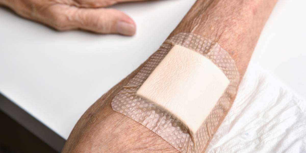 Advanced Wound Care Market Insights Reveal Advanced Wound Care Therapy Shaping Clinical Decision Making
