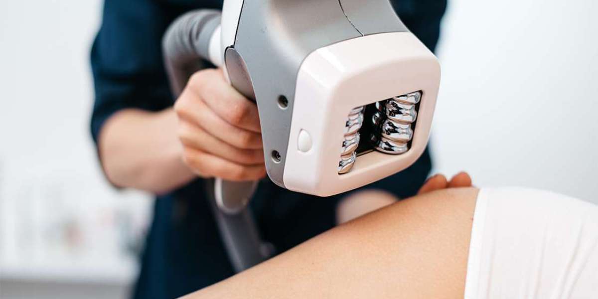 What is the Recovery Time for Velashape 3 Treatment?