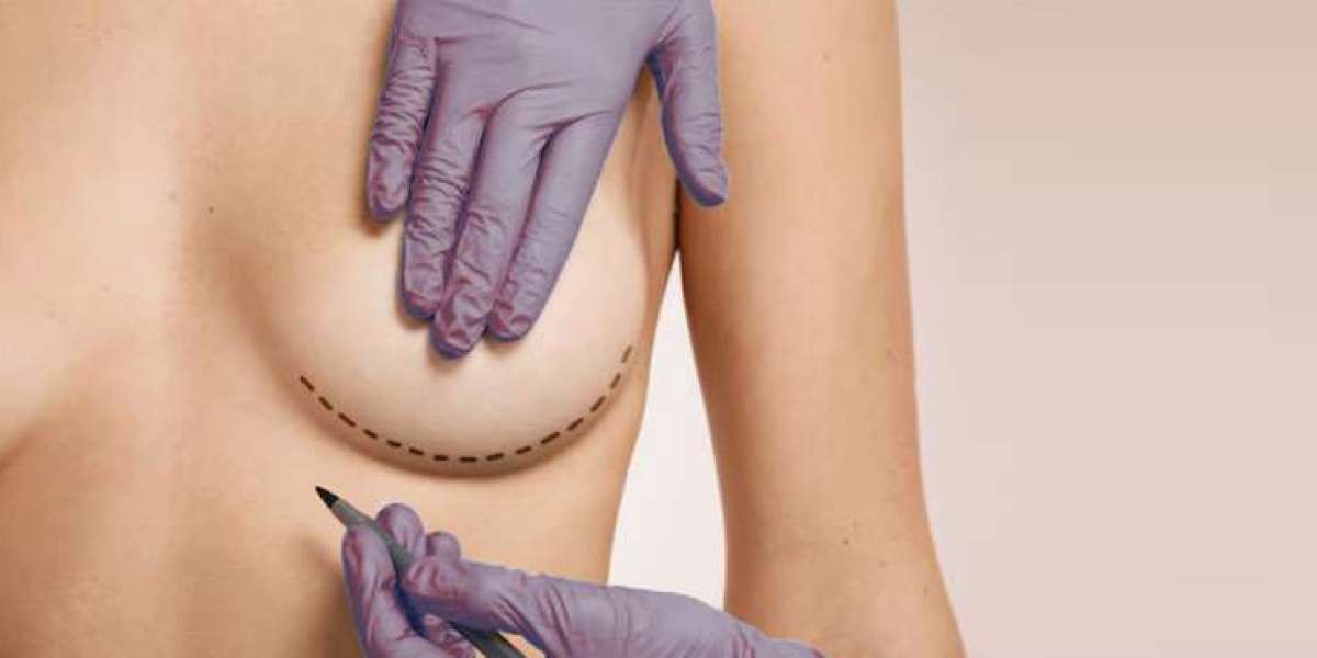 Inverted Nipple Surgery and Sensation Changes Explained