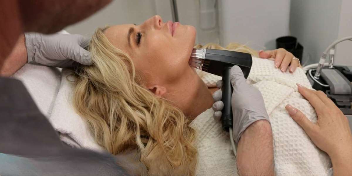 Transform Your Skin: Morpheus8 RF in Mississauga