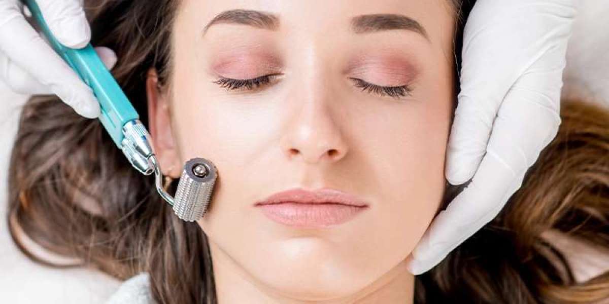 Is Derma Rollers Treatment Safe?