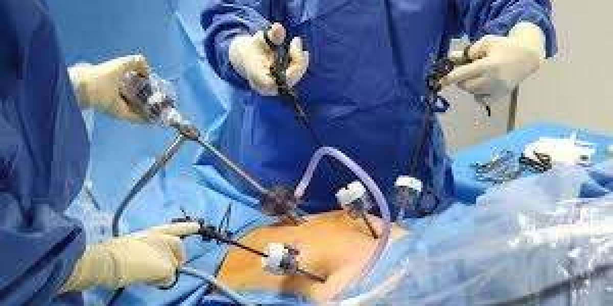 Liposuction for a More Contoured Appearance
