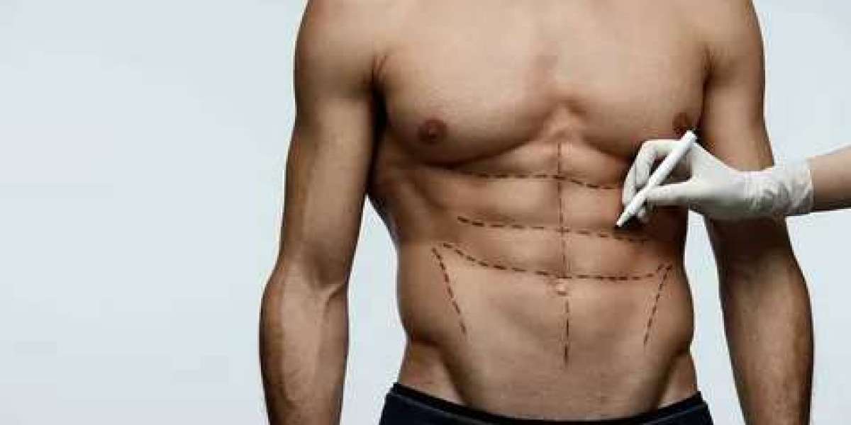 How Many Calories Should You Eat for Six Pack Abs?