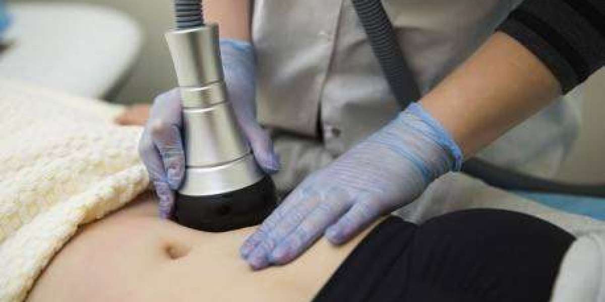 Who is an Ideal Candidate for Fat Reduction?