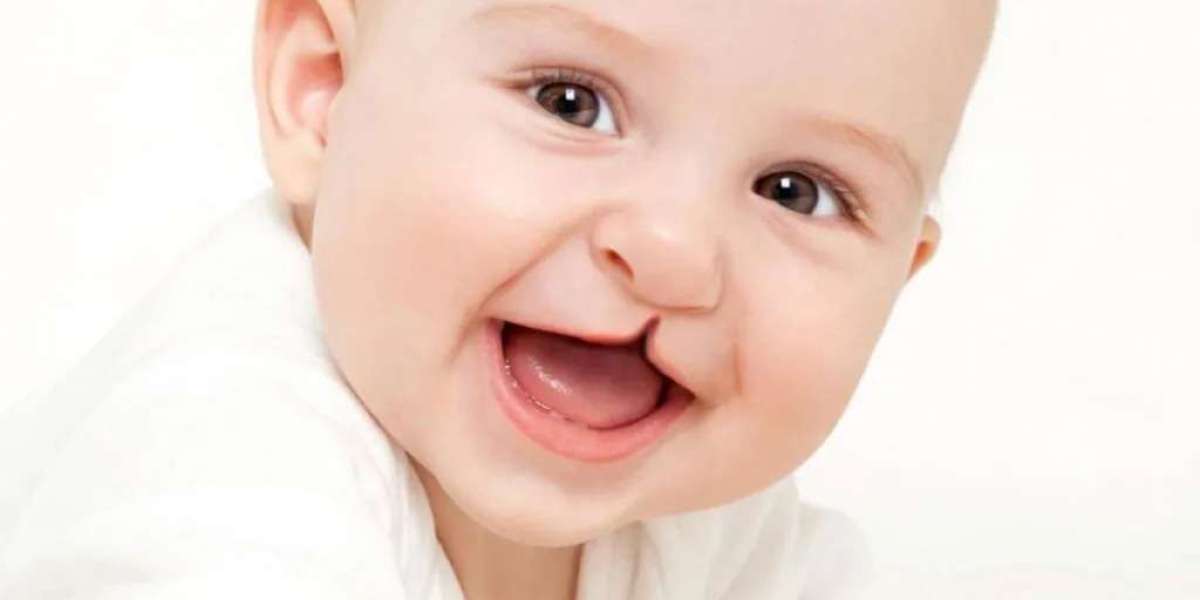 How Early Can Cleft Lip Surgery Be Done?