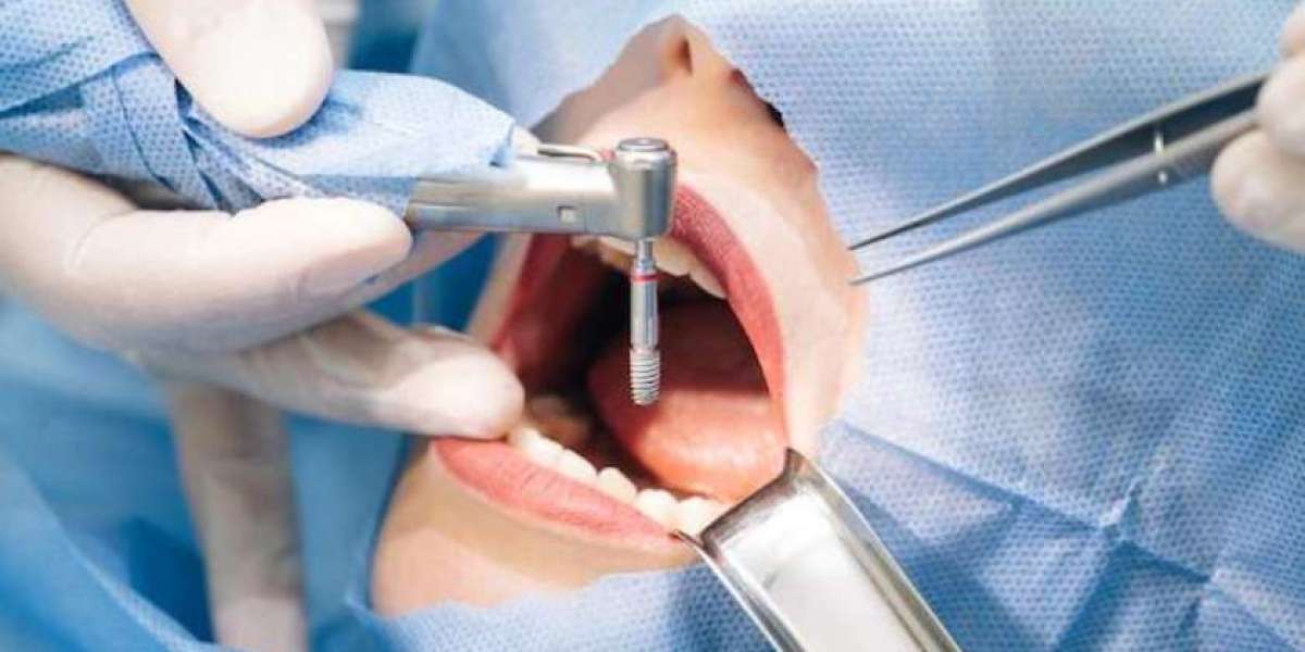 What Are the Benefits of Dentistry?