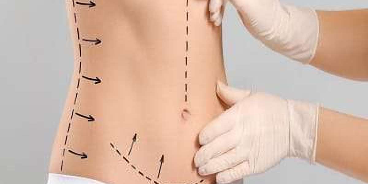 Is BodyTite Liposuction Suitable for Small Treatment Areas?