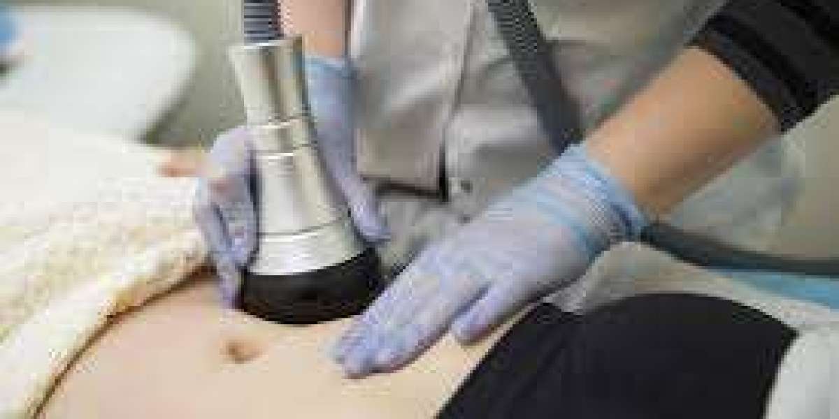 Fat Removal for Smooth Body Contours