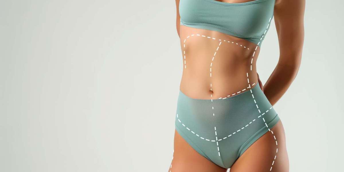 What is Sculpsure Body Contouring?