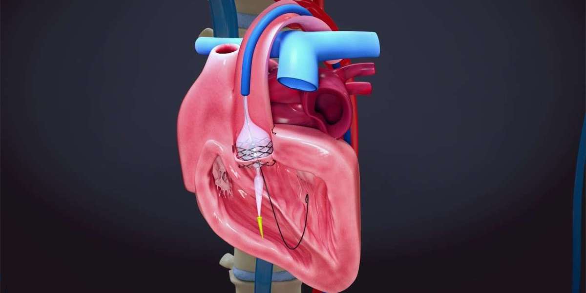 Heart Valve Devices Market Potential Unlocking Future Opportunities in Cardiovascular Care