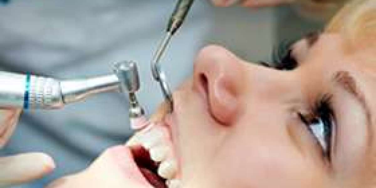 Complete Oral Hygiene Solutions with Teeth Scaling and Polishing in Islamabad