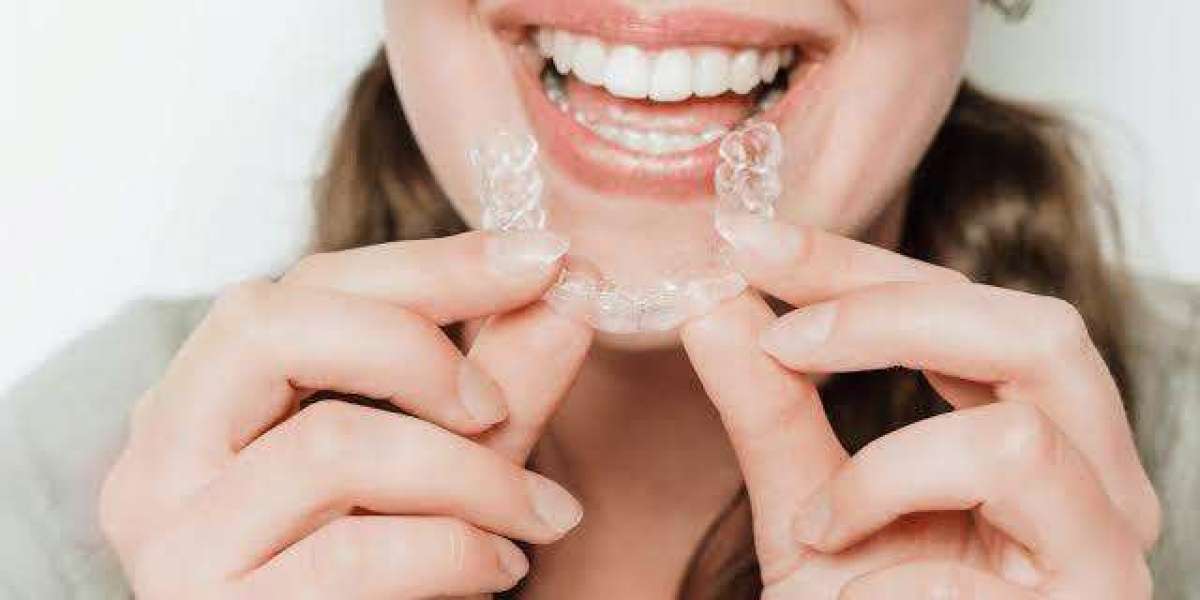 Teeth Aligners for a Better Looking Smile